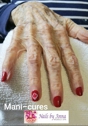 Diabetic manicure - nails by anna mobile spa
